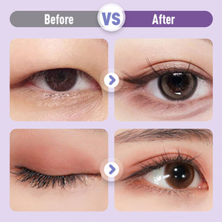 BeautyFold - Natural Look Eyelid Cream