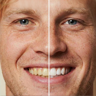 WhiteBloom – Instant Smile Brightener