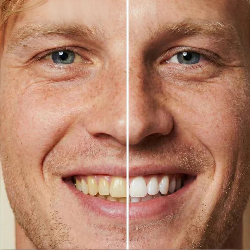 WhiteFlash – Instant Tooth Whitening Paint