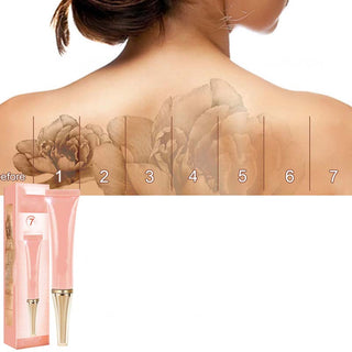 FadeEase – Gentle Tattoo Fading Cream