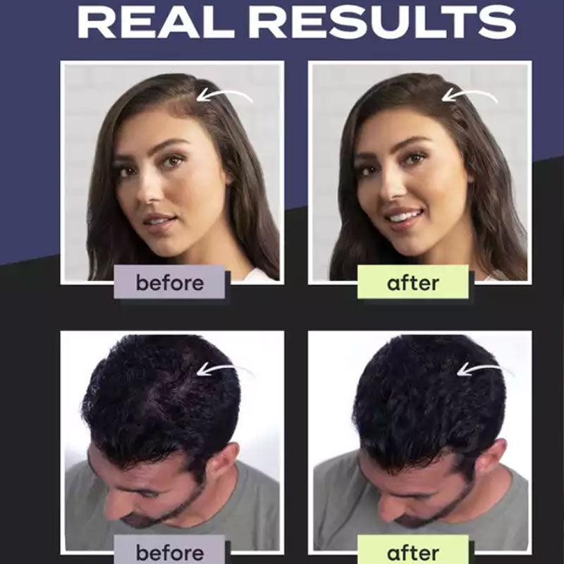 FiberLuxe – Natural-Looking Hair Thickening Fibers Set
