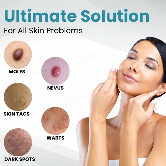 ClearDerm – Precision Laser Pen