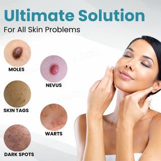 ClearDerm – Precision Laser Pen