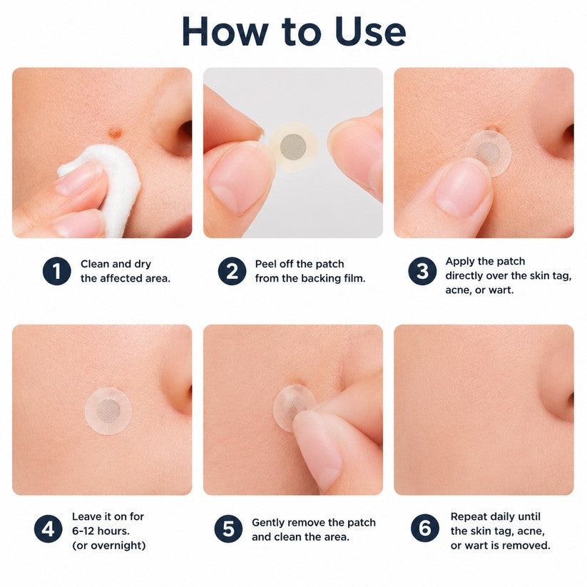 🌟 Curalona® 2-in-1 Microneedle & Hydrocolloid Patch 🌿 Invisible Face & Body Patches for Raised Moles, Acne, Flat Warts & Skin Tags - Helps Improve the Appearance of Wrinkles, Scars & Blemishes