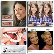 SmileEase – Hassle-Free Snap-On Dentures